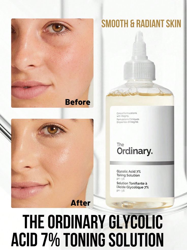The Ordinary Glycolic Acid 7% Toning Solution