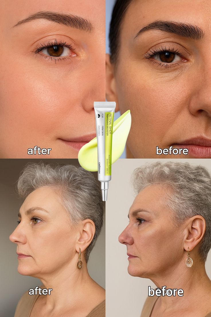 celimax The Vita A Retinal Shot Tightening Booster